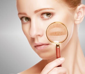 woman-facial-problem woman facial problem